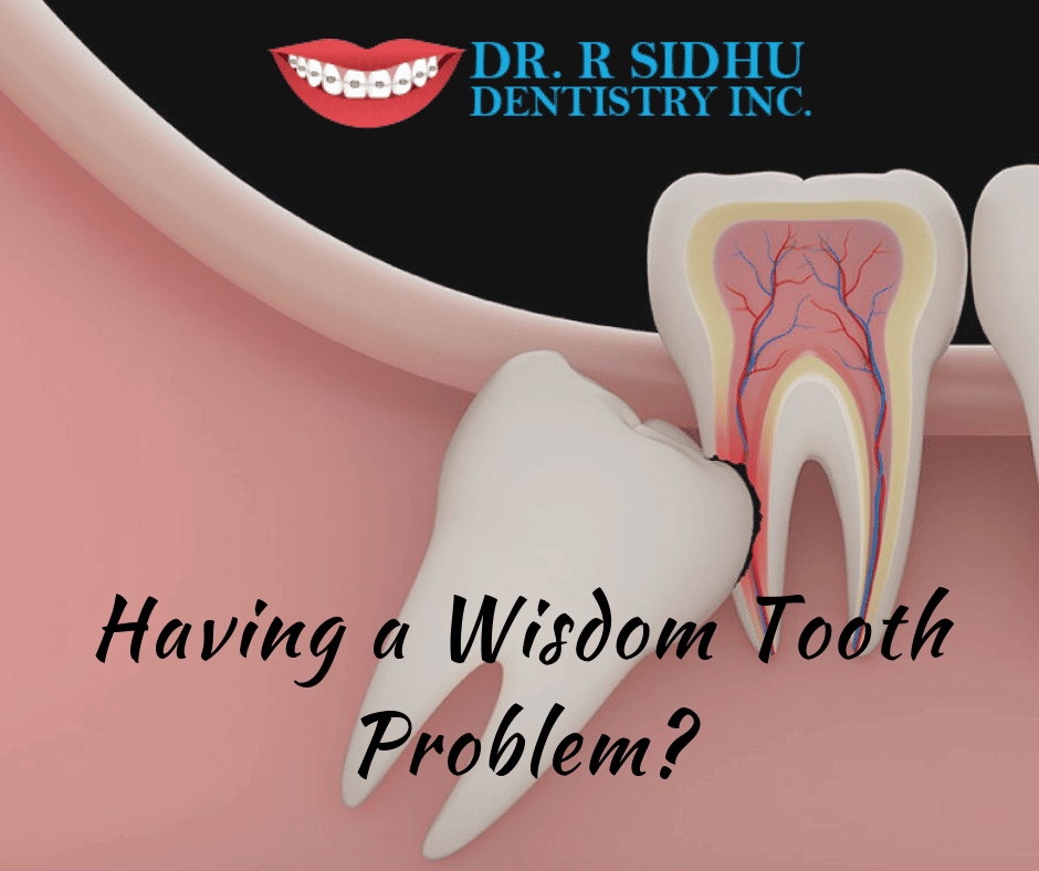 What To Do If You Have A Wisdom Tooth Infection