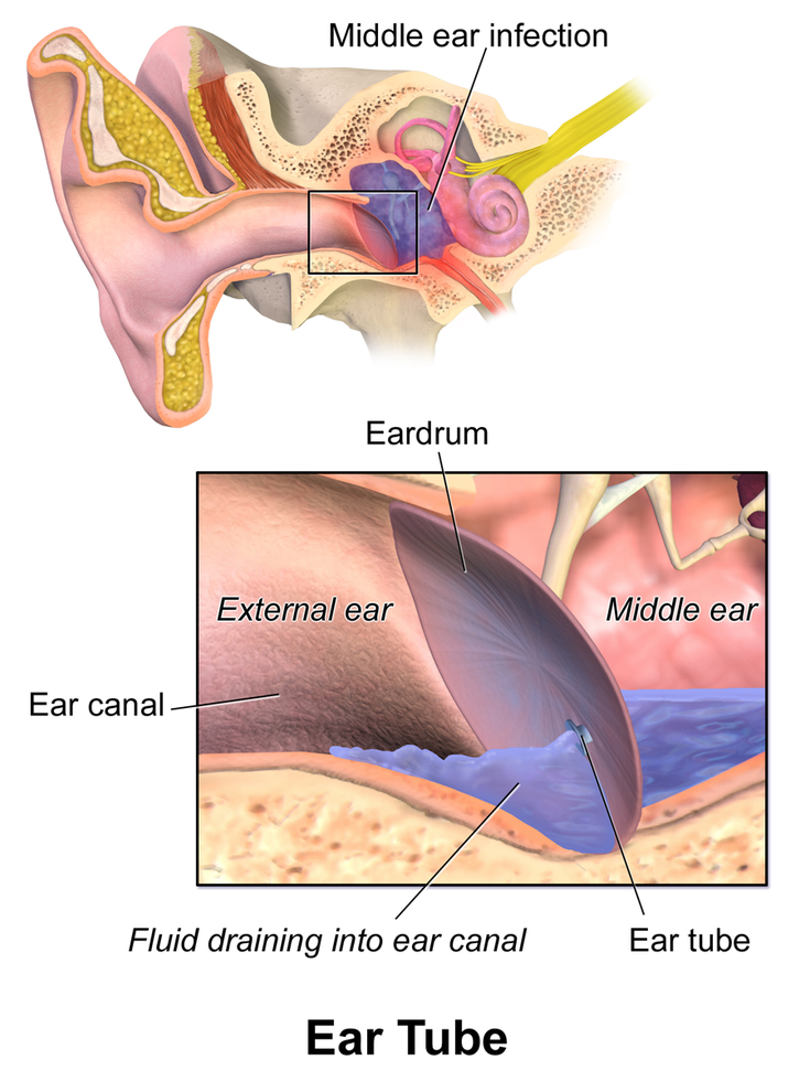 When to See a Doctor About Ear Drainage