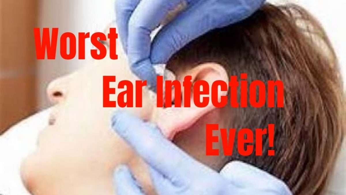 Worst Ear Infection Ever! Must See! Recommendations to treat an ear ...