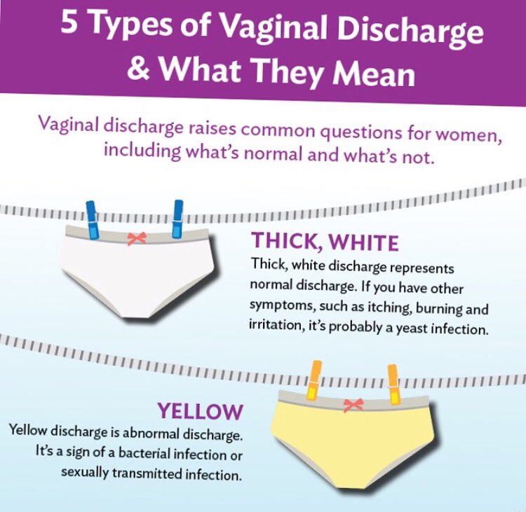 WunmiOmololu on Twitter: " However, certain types of vaginal odor and ...